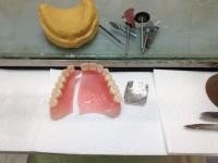 JMC Dentures repair Prices Starting at $39